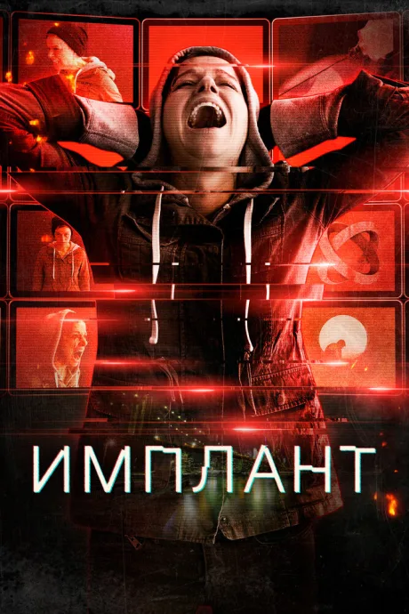 Имплант — постер